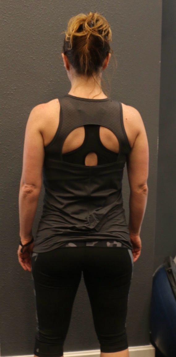 Stacy's transformation — after